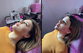 До та після - фото 19