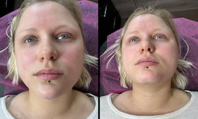 До та після - фото 11